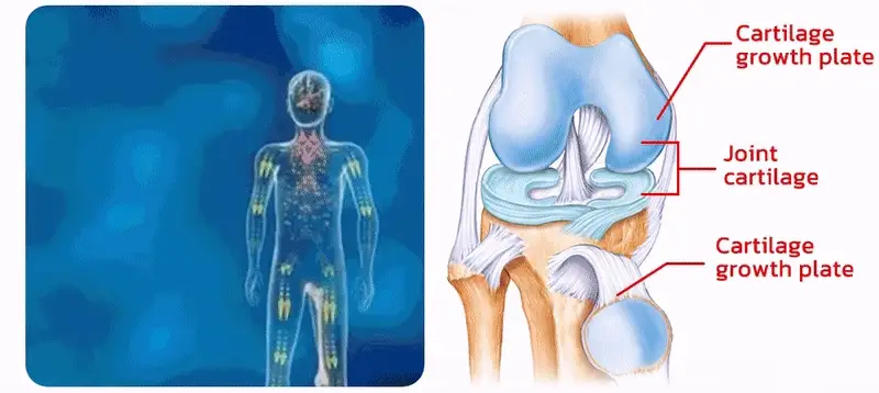Cartilagine articolare