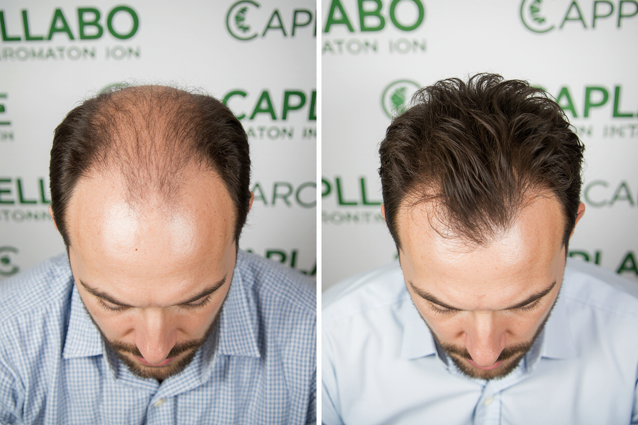 Risultati Capellabo - Testimonianza Giovanni S.